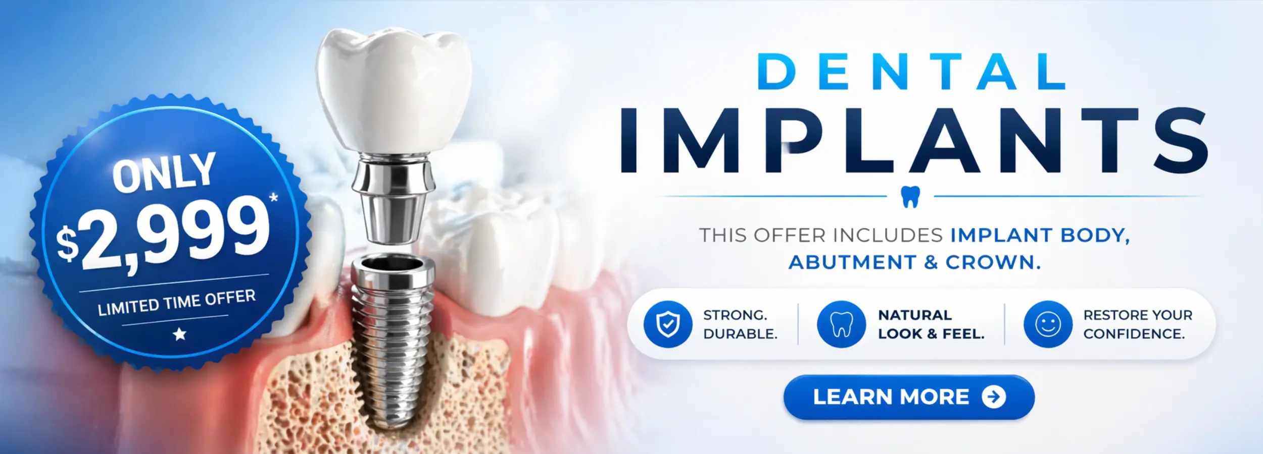 Dental Implants Website Banner
