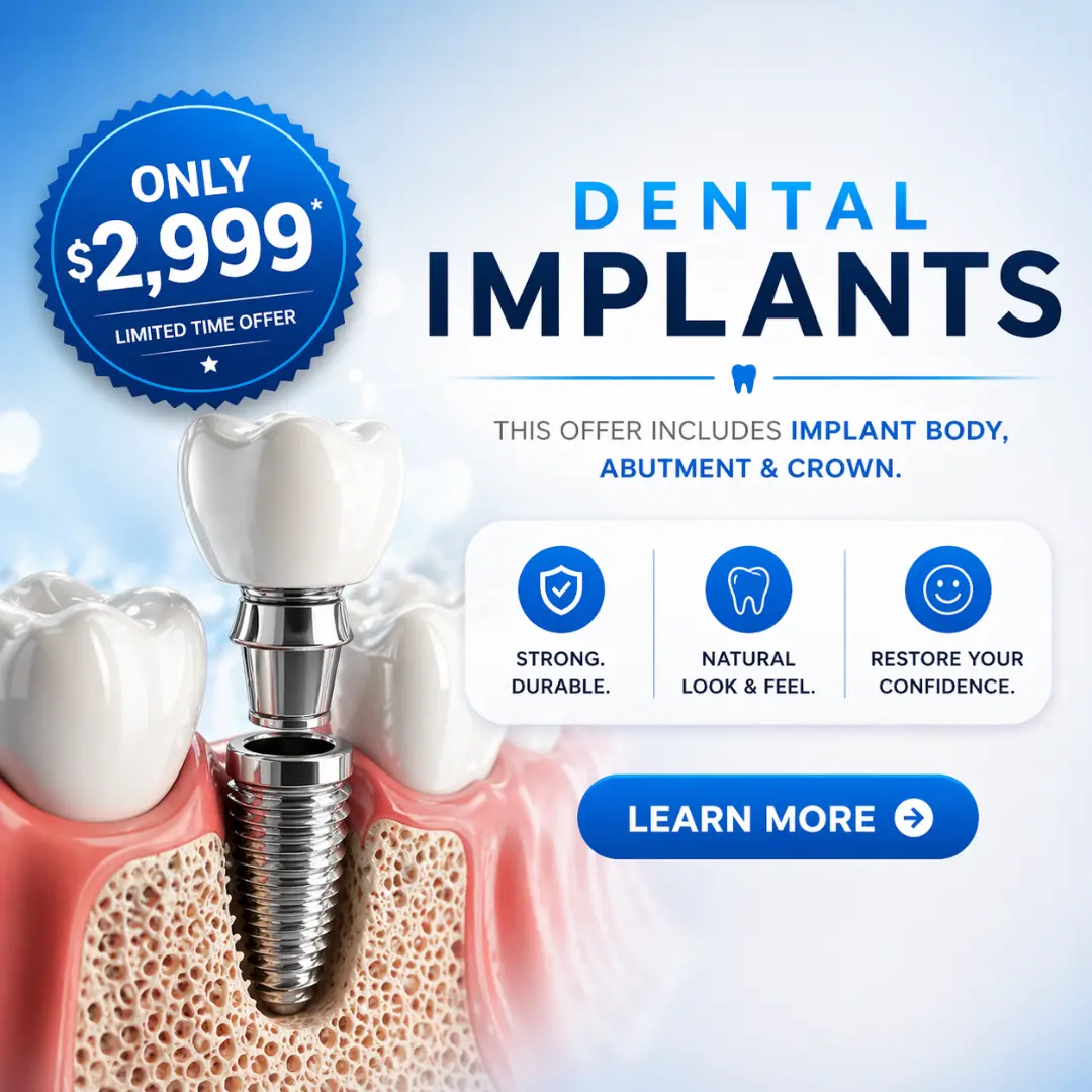 Dental Implants Mobile Banner