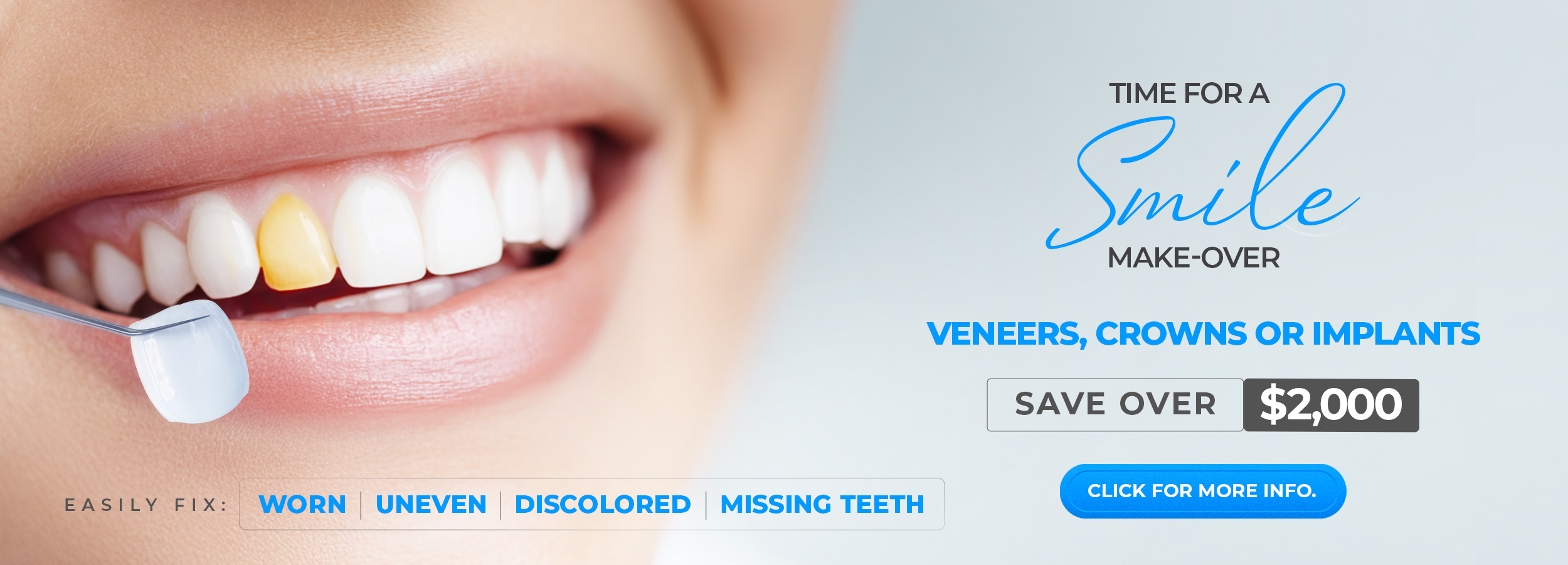 Smile Makeover in Texas
