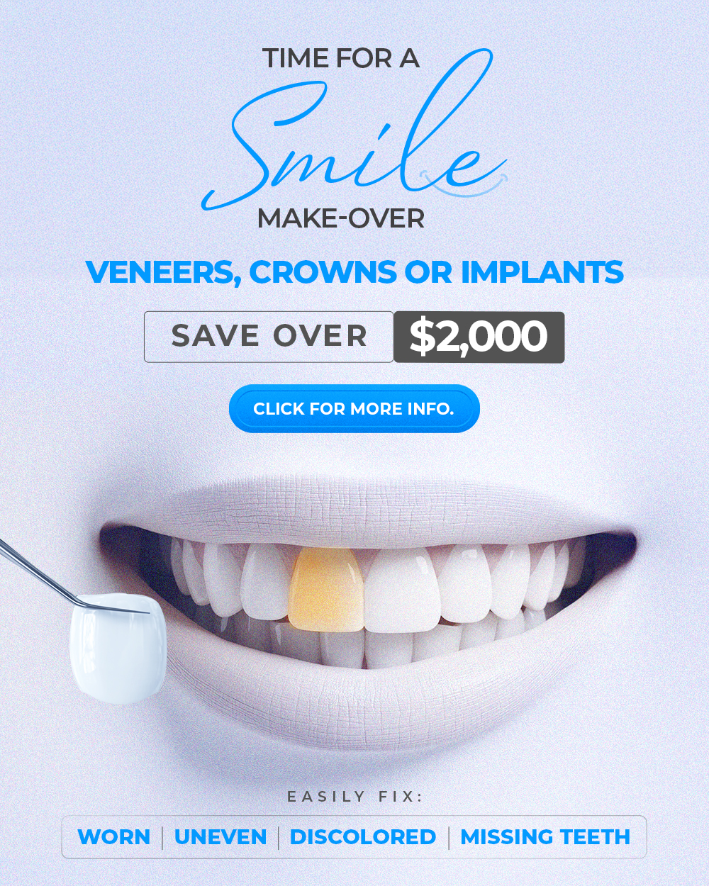 Dental implant in texas
