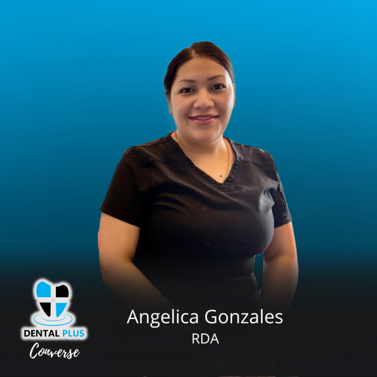 Cponverse - Angelica G - RDA