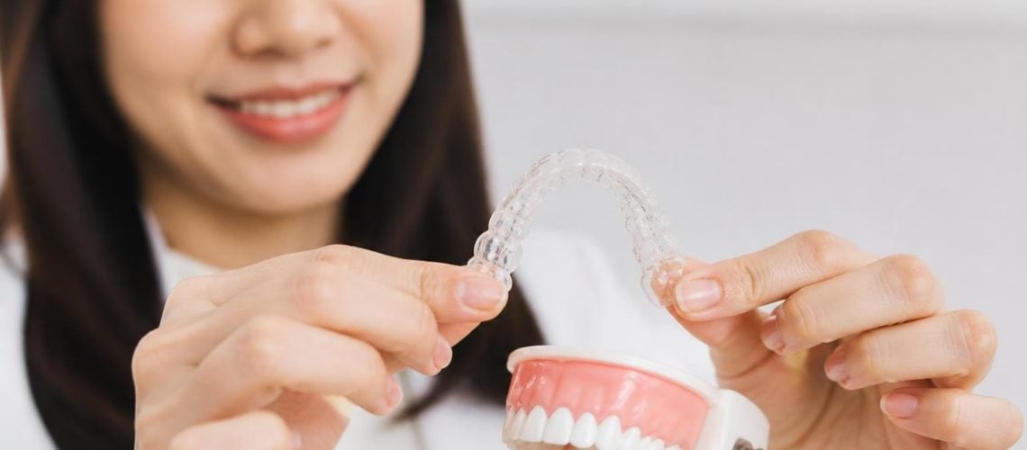 Can Clear Aligners Fix an Overbite? Expert Guide 2026