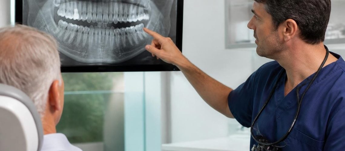 Can You Get Dental Implants If You Have Bone Loss?