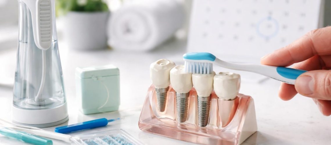 How to Care for Dental Implants: Complete 2026 Guide