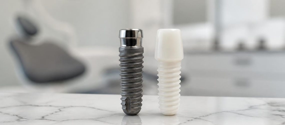 Titanium vs Ceramic Dental Implants: 2026 Guide