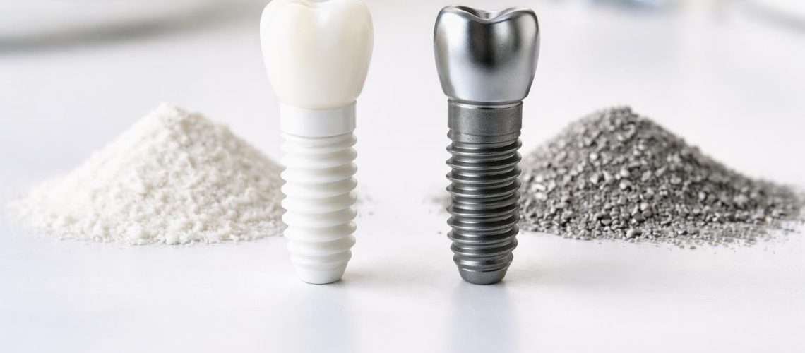 Zirconia vs Titanium Implants: Which Is Better?